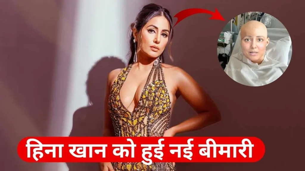 Hina Khan Diagnosed with Mucositis Due to Side effect of Chemotherapy हिना खान को हुआ मउकोसिटीस 